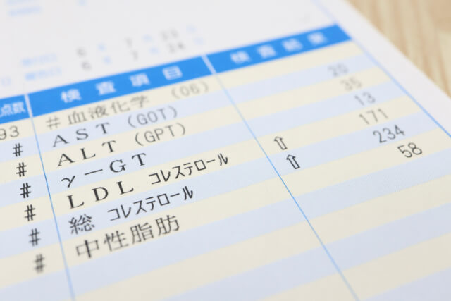 検査